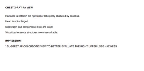 What is the significance of 'suspicious densities' observed on the .